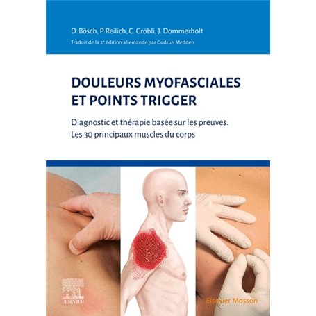 Douleurs myofasciales et points trigger