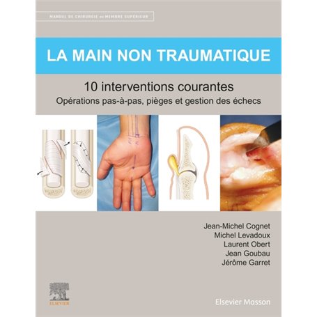 La main non traumatique 10 interventions courantes