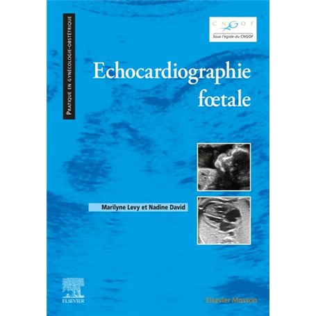 Echocardiographie foetale