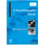 Echocardiographie foetale