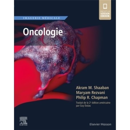 Imagerie médicale : Oncologie