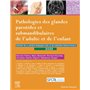 Pathologies des glandes parotides et submandibulaires de l'adulte et de l'enfant