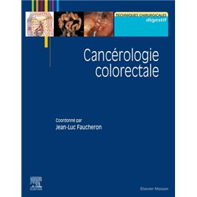 Cancérologie colorectale