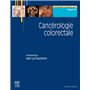 Cancérologie colorectale