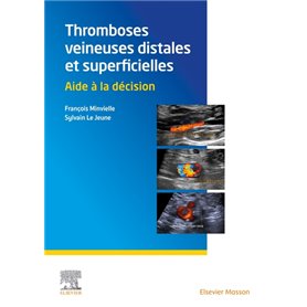 Thromboses veineuses distales et superficielles