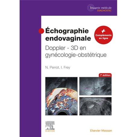 Échographie endovaginale Doppler - 3D