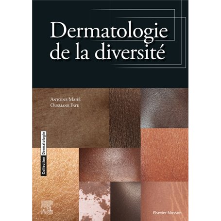 Dermatologie de la diversité