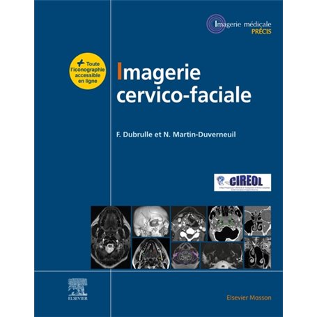 Imagerie cervicofaciale