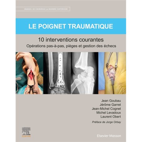 Le poignet traumatique 10 interventions courantes