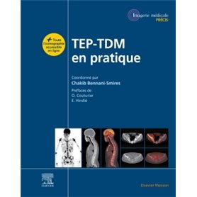 TEP-TDM en pratique