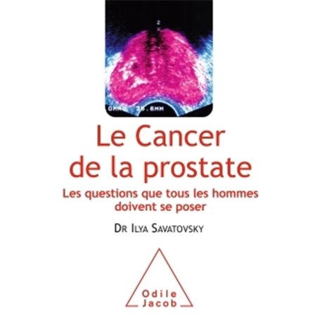 Le Cancer de la prostate