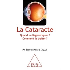 La Cataracte