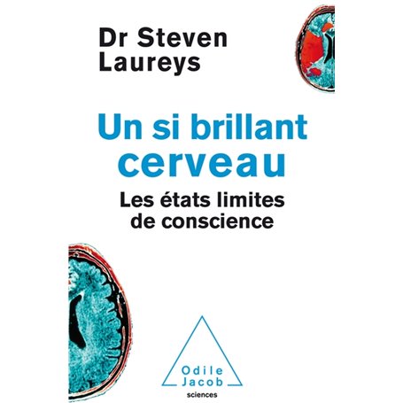 UN SI BRILLANT CERVEAU