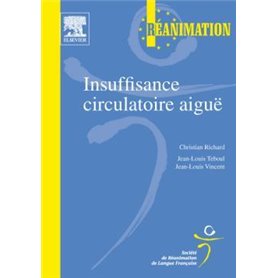 Insuffisance circulatoire aiguë