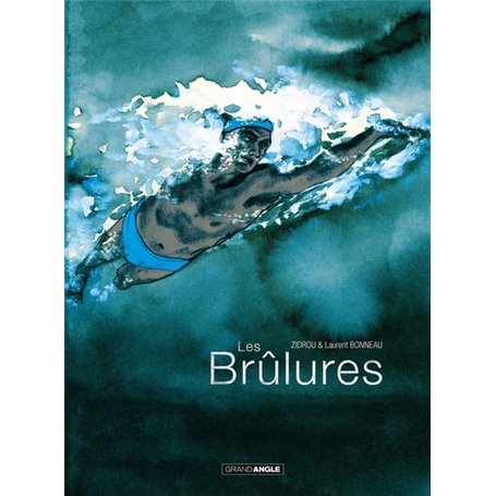 Les Brûlures - histoire complète