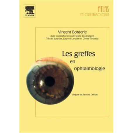 Les greffes en ophtalmologie