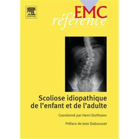 Scoliose idiopathique de l'enfant, de l'adulte