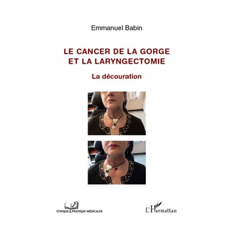 Cancer de la gorge et la laryngectomie