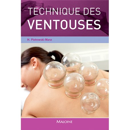 TECHNIQUE DES VENTOUSES