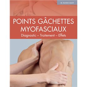 Points gâchettes Myofasciaux