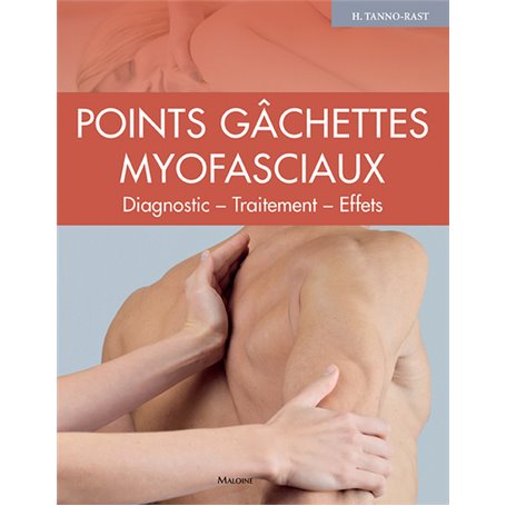 Points gâchettes Myofasciaux