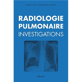 Radiologie pulmonaire : investigations