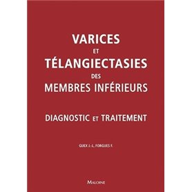 Varices et teleangiecasties des membres inferieurs