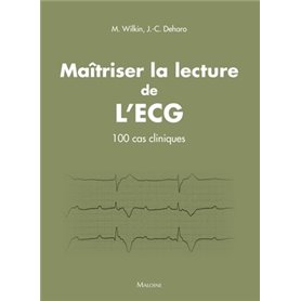 Maitriser la lecture de l'ecg