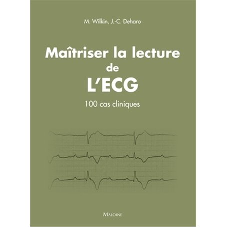 Maitriser la lecture de l'ecg