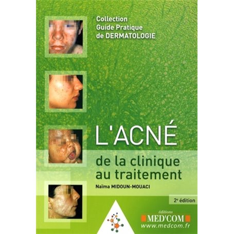 L ACNE 2E ED CLINIQUE AU TRAITEMENT