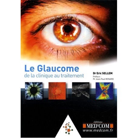 LE GLAUCOME