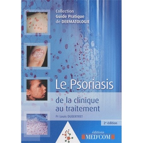 LE PSORIASIS 2E EDITION