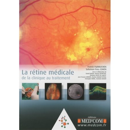 LA RETINE MEDICALE