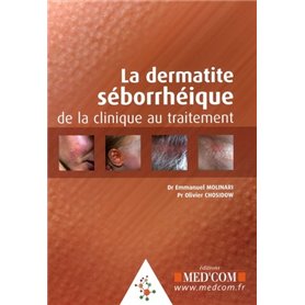 LA DERMITE SEBORRHEIQUE DE LA CLINIQUE AU TRAITEMENT