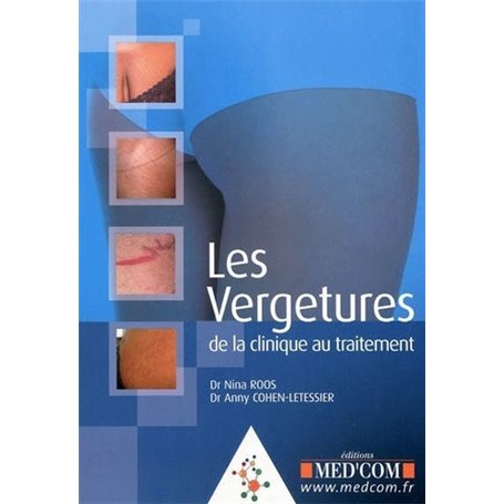 LES VERGETURES