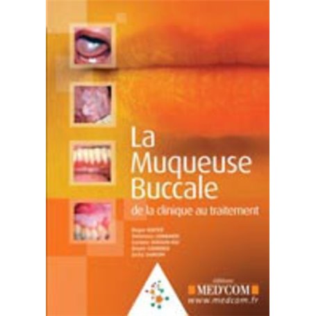 LA MUQUEUSE BUCCALE