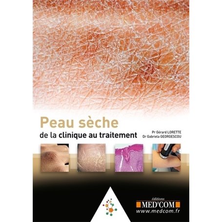 PEAU SECHE : DE LA CLINQUE AU TRAITEMENT