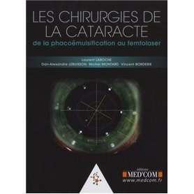 LES CHIRURGIE DE LA CATARACTE. DE LA PHACOEMULSIFICATION AU FEMTOLASER