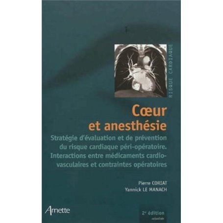 Coeur et anesthésie 2eme édition