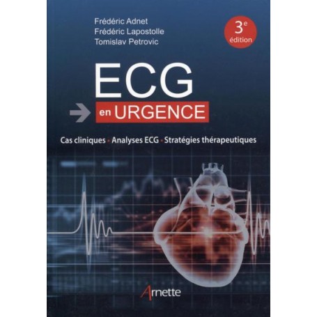 ECG en urgence