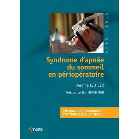 Syndrome d'apnée du sommeil en périopératoire