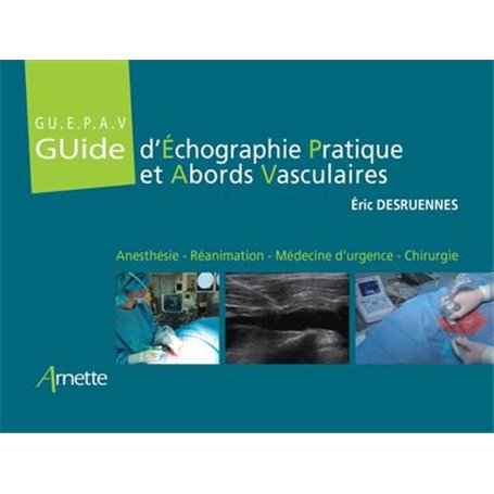 Guide d'Échographie Pratique et Abords Vasculaires (GU.E.P.A.V)