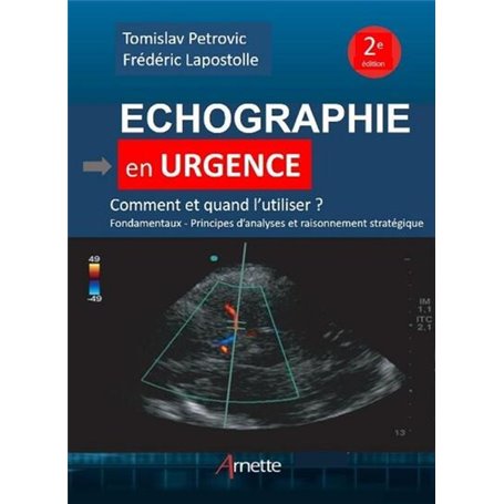 Echographie en urgence