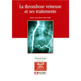 Thrombose Veineuse