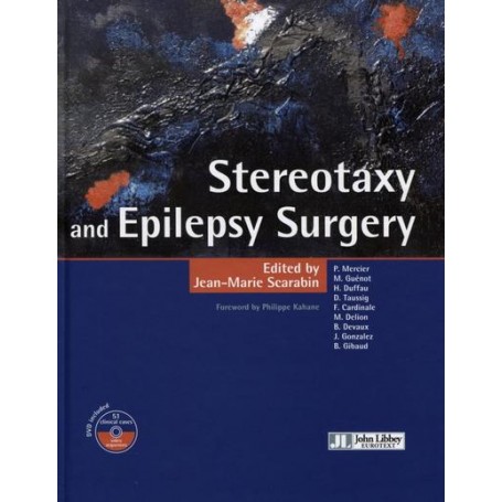 Stereotaxy and Epilepsy Surgery