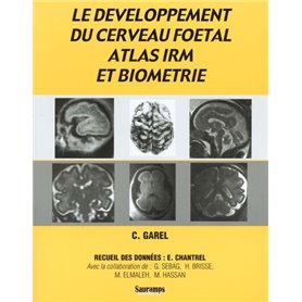 DEVELOPPEMENT DU CERVEAU FOETAL