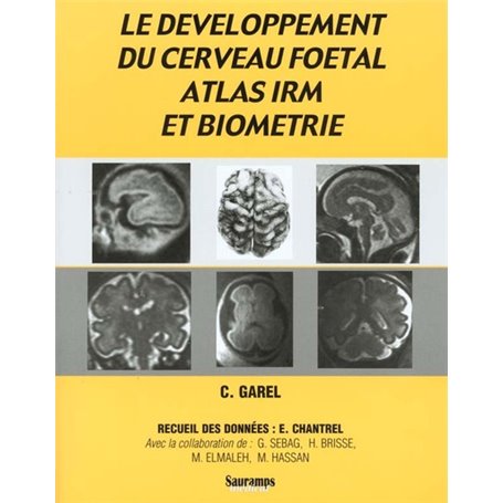 DEVELOPPEMENT DU CERVEAU FOETAL