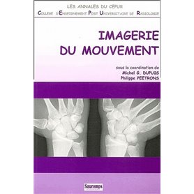 IMAGERIE DU MOUVEMENT