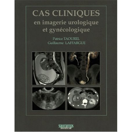 CAS CLINIQUES EN IMAGERIE UROLOGIQUE ET GYNECOLOGIQUE