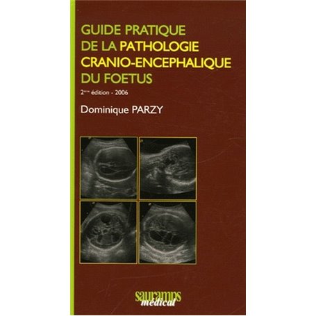 GUIDE PRATIQUE DE LA PATHOLOGIE CRANIO ENCEPHALIQUE